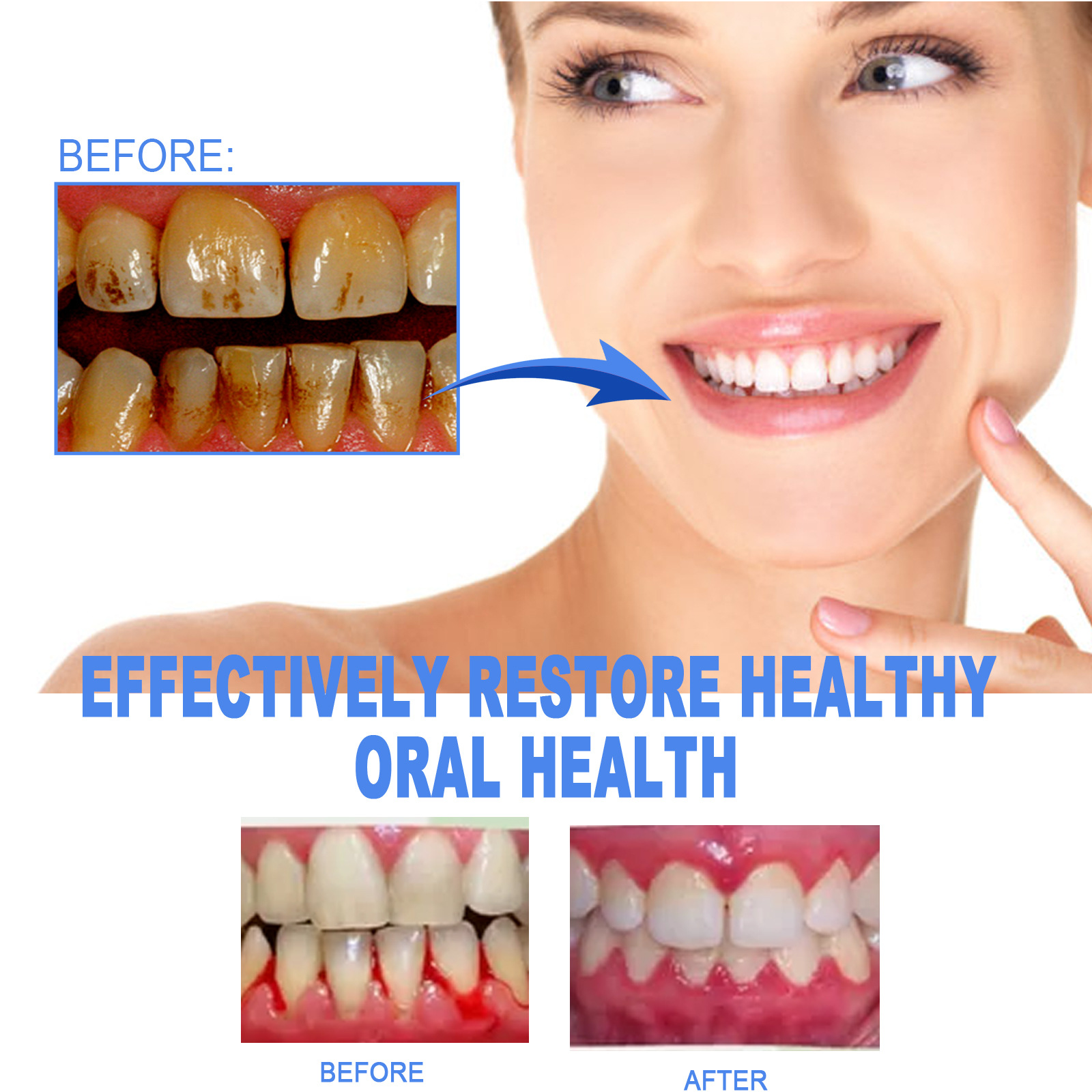 (1pc) EELHOE Gum Protect Repair Gel Treatment Therapy Tooth Repair Gel Oral Care Deep Cleansing Tartar and Stains Reinforcing Tooth Gel tooth Repair Gel 4ml