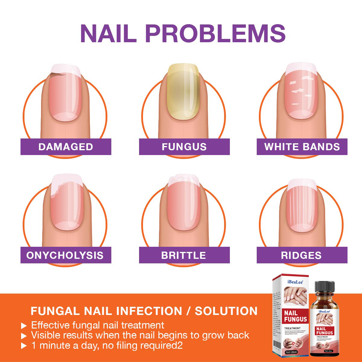 iBeaLee Nail Fungus Treatment Onychomycosis Repair Liquid Anti-Infective Oil Essence Serum Hand And Foot Care Supplies for Men Women 20ml