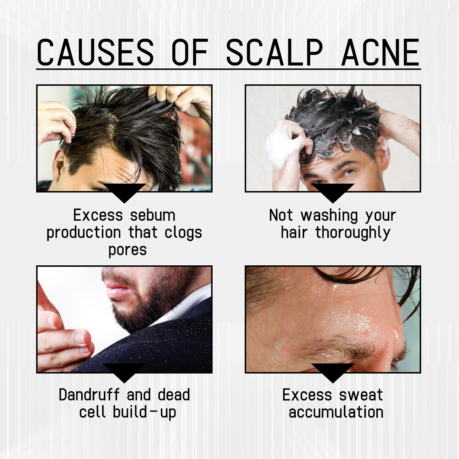 Anti Shedding Hair Spray Hair Growth Essence Hair Care Serums Improves Hairline Density Strengthens Hair Nourishes Hair Root Gel 100ml
