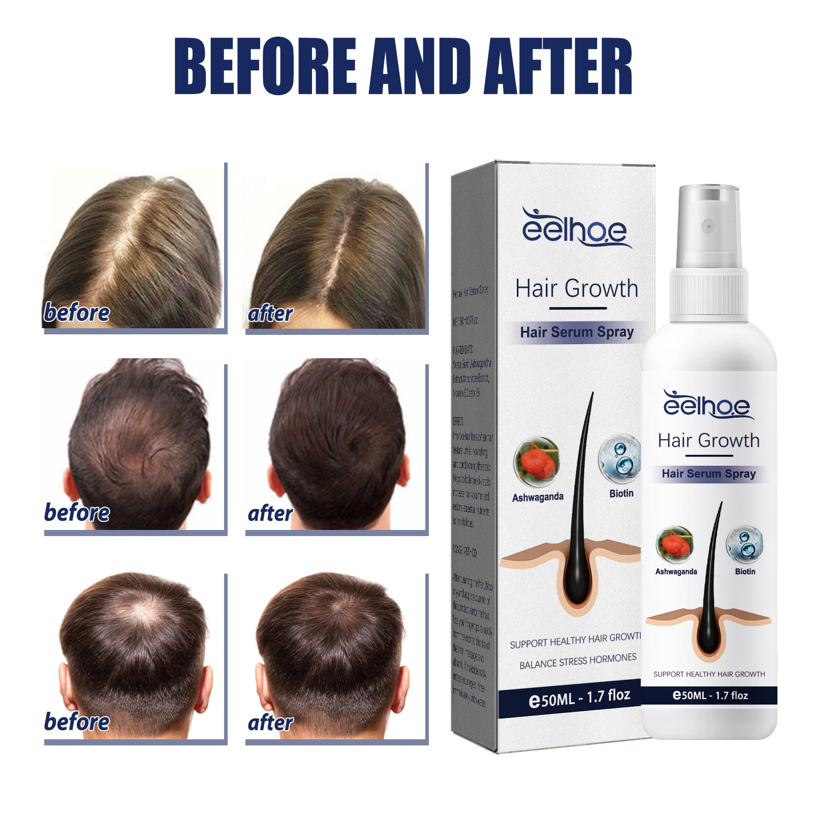 Herbal Hair Care Essential Oil Root Care Essential Serum Hair Strengthen Anti Hair Loss Dense Hair