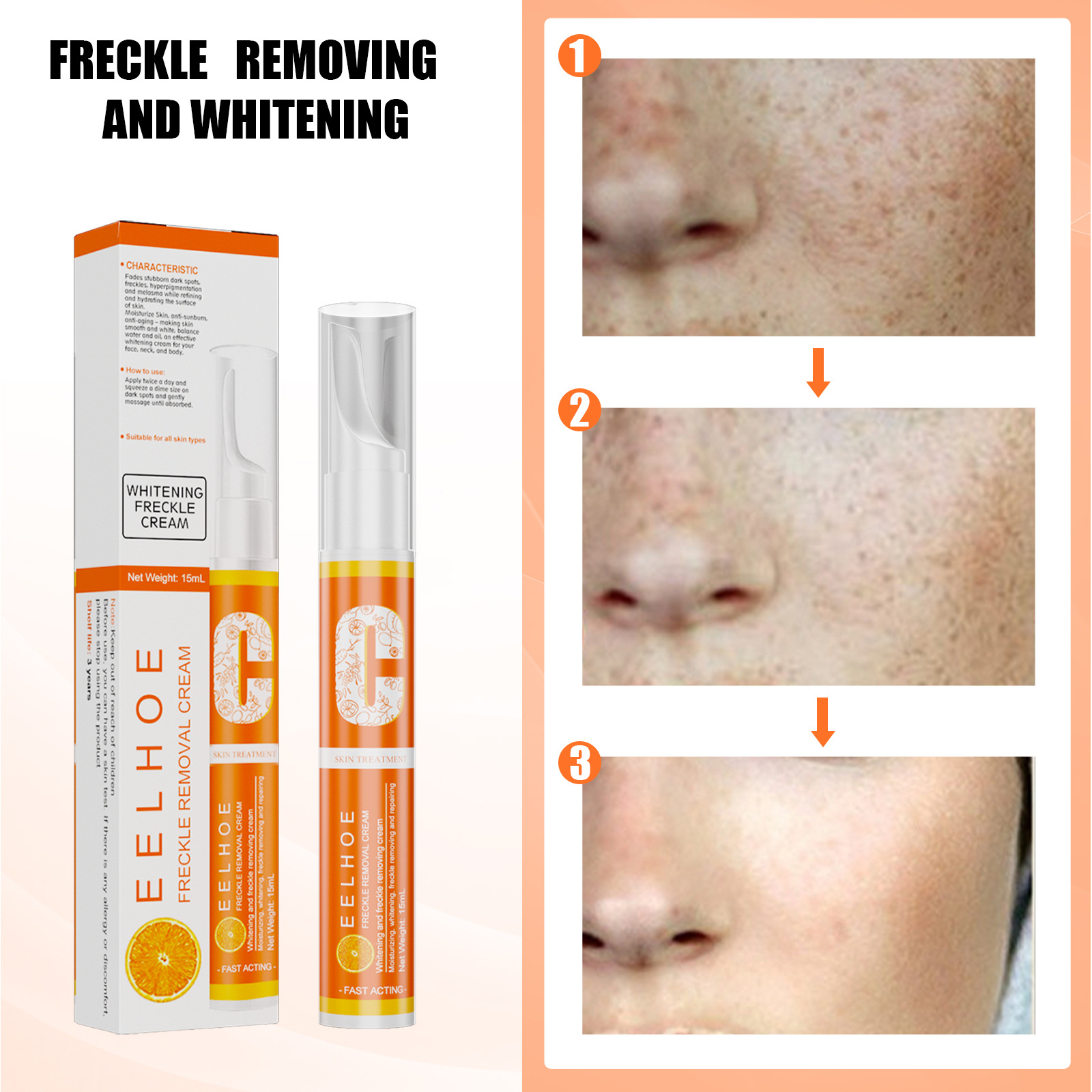 Whitening Freckles Cream Anti Freckle Pen Melanin Spots Cream Vitamin C Blemish Removal  Hydrating