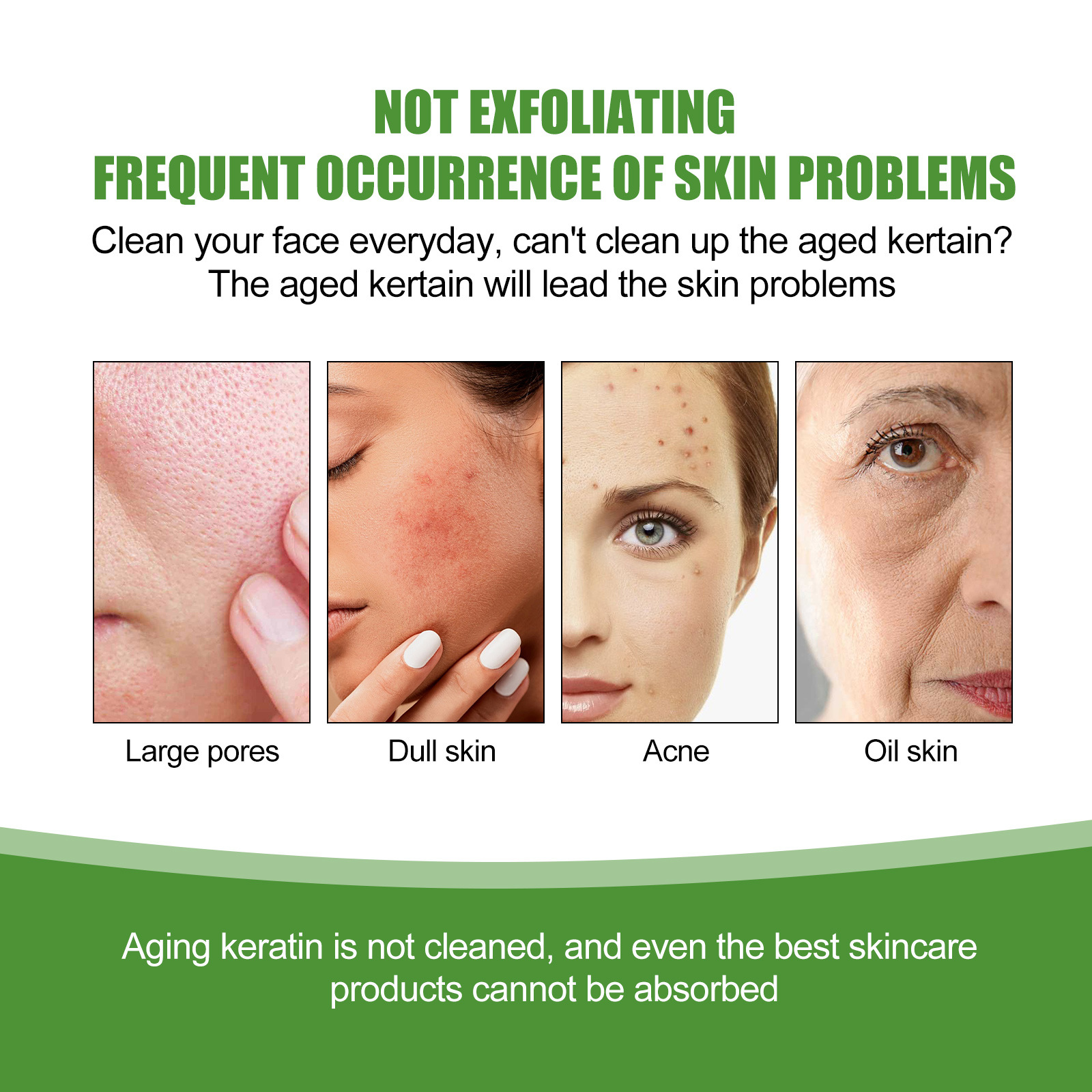 Aloe Exfoliator Gel Face Exfoliating Cream Shrink Pore Blackhead Acne Treatment Scrubs Dead Skin Removal Smooth Whitening Moisturizing Peeling Gel
