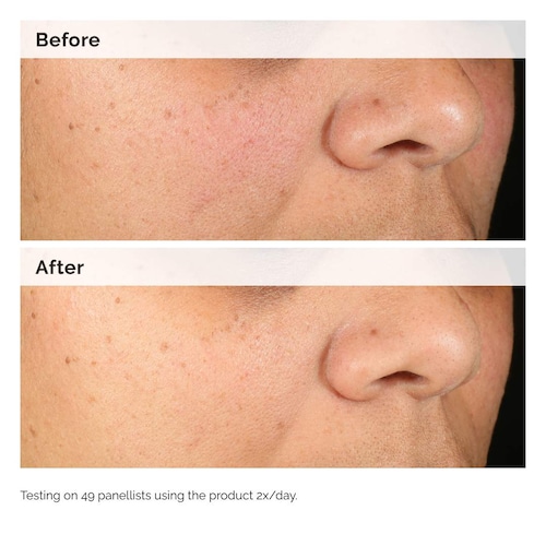 The Ordinary Alpha Arbutin 2 Percent HA Hyperpigmentation Serum 60ml