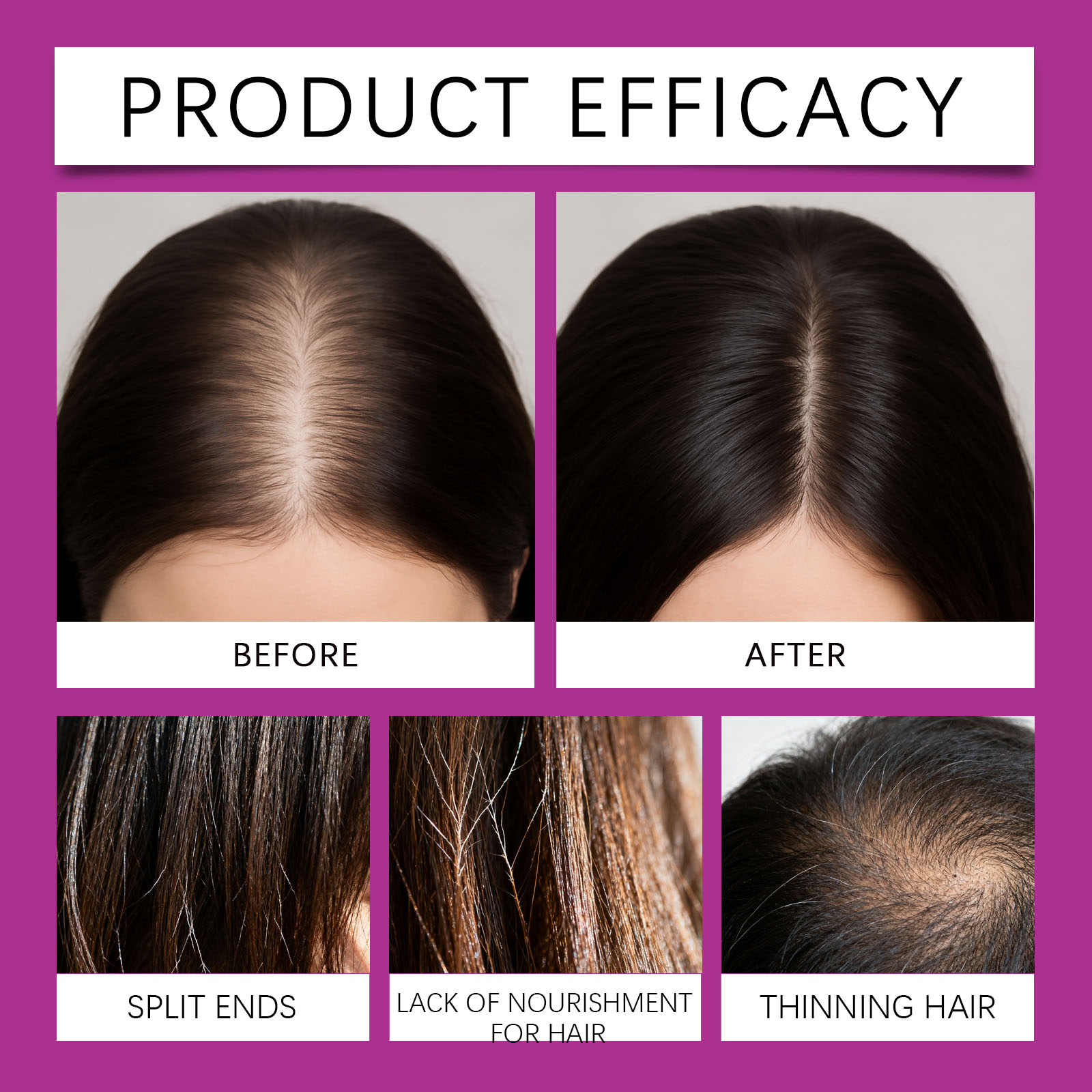 Hair Care Gummy Collagen Gentle Protect Scalp Daily Supplement Plump Nourish Hair Maintain Balance Soft Safe Natural Healthy Mild Rich