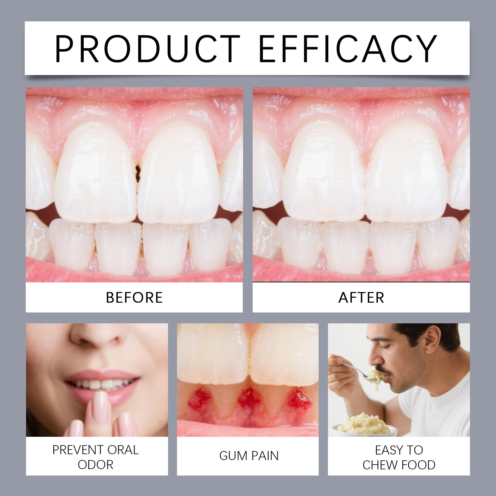 Denture Adhesive Provides Natural Fit Comfortable Hold Enhances Smile Beauty For Dentures