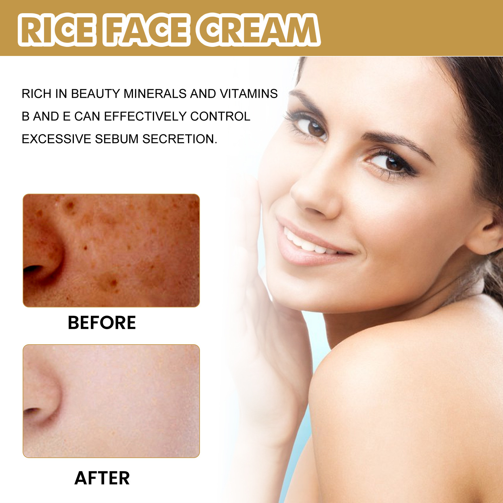 Rice Face Cream Anti Dark Spots Cream Brighten Whitening Melasma Freckles Blemish Remove  Melanin Pigmentation Corrector
