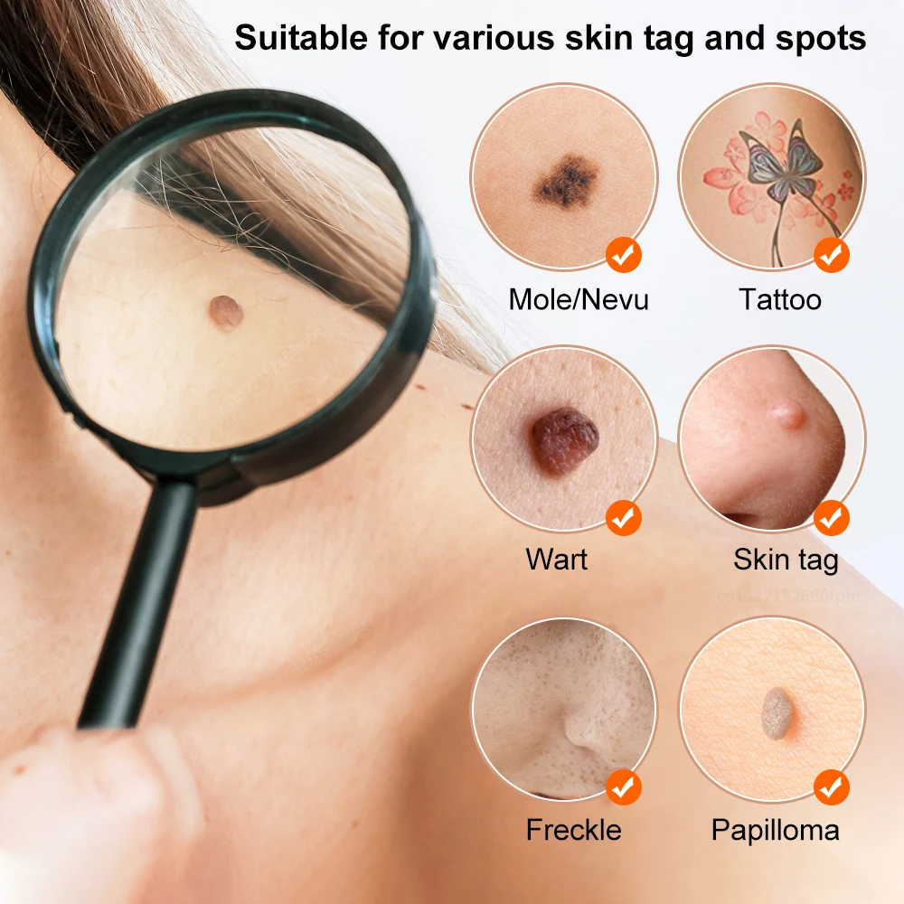 Black Dots Remover by Plasma Pen Beauty Skin Care Products Skin Tag Removal Face Cleaning Tools Tattoo Freckle Dark Spot Mole Warts Eliminator Machine
