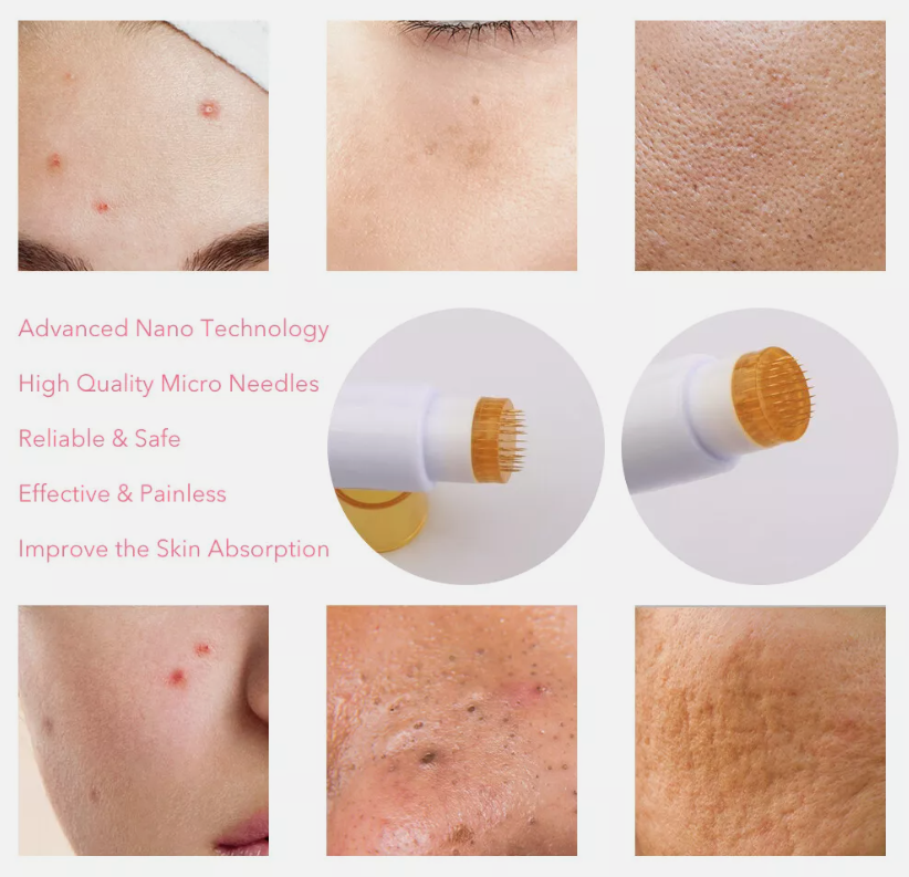 (0.2mm) DRS 40 Needle Titanium Derma Stamp Micro Needling Professional Therapy System Seal Needle for Face Skin Care Scalp Hair Beard Growth Beauty Equipment Tool