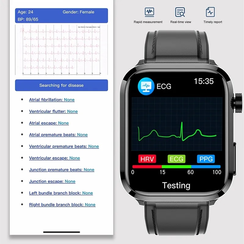 Medical Grade Smart Watch Blood Sugar Blood Lipid Uric Acid ECG Bracelet