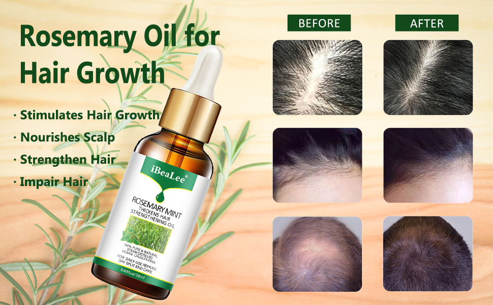 Rosemary Mint Hair Strengthening Oil Hair Growth Serum Hair Growth Nutrient Solution Conditioner for Men And Women 20ml