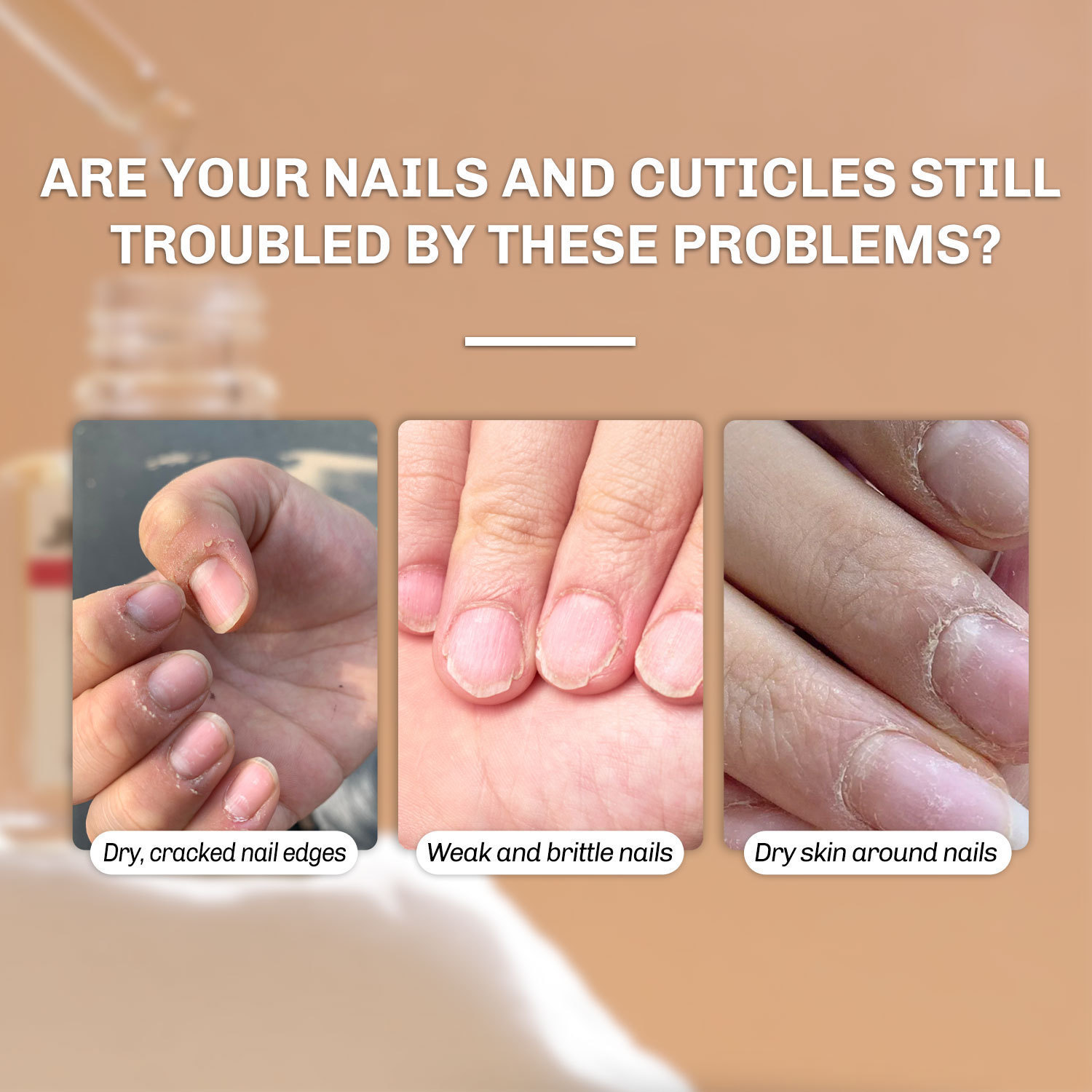Cuticle And Nail Nourishing Oil Moisturizing Strengthening For Dry Cuticles And Brittle Nails Daily Home Manicure Care