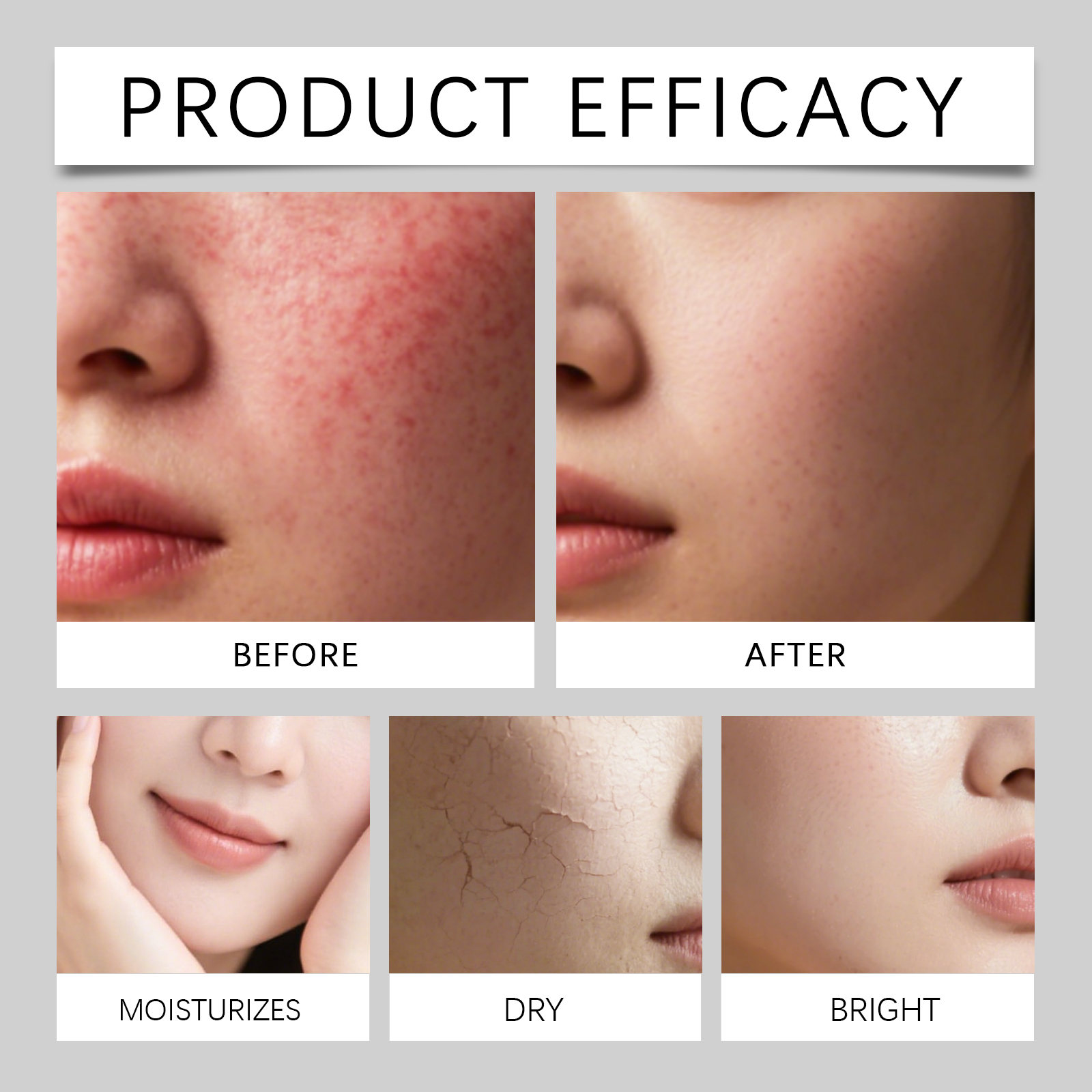 Azelaic Acid Moisturizing Cream Delicate Silky Mild Refreshing Hydrating Bright Even Skin Tone Daily Facial Skin Care