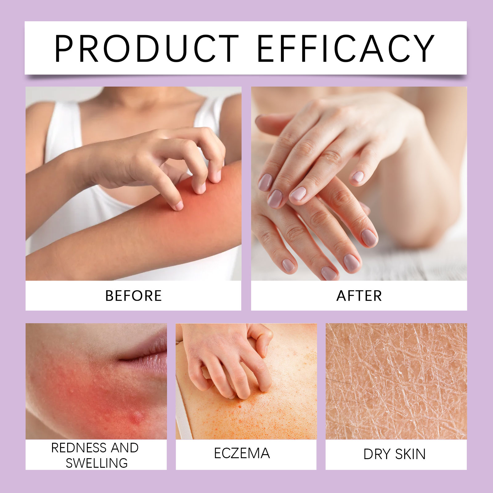 Local Skin Purifying Cream Mild Cleansing Nourishing Refreshing Non Sticky Soft Body Care Lotion