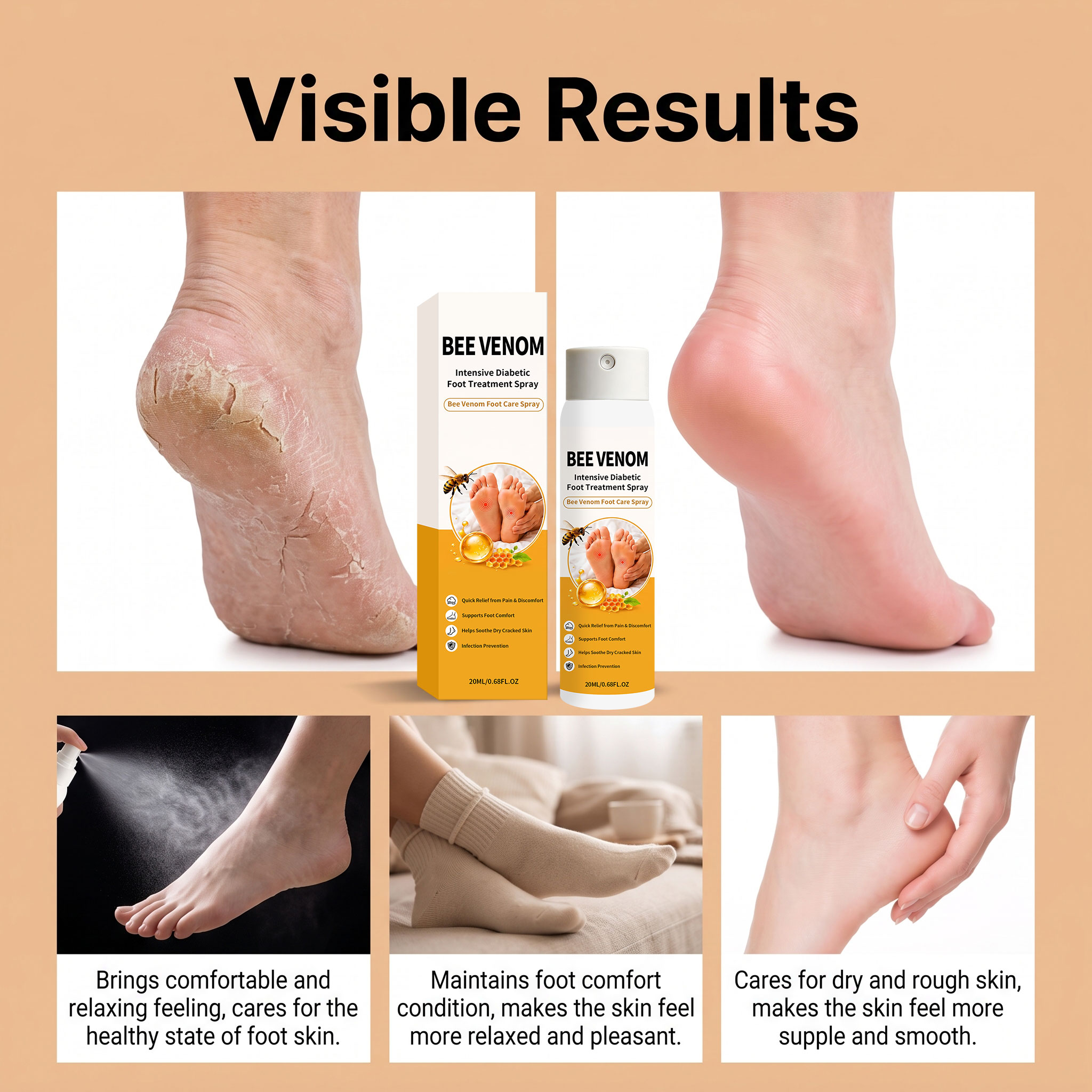 Bee Venom Foot Care Spray Mild Moisturizing Dry Skin Lock Water Soft Comfort Exfoliating