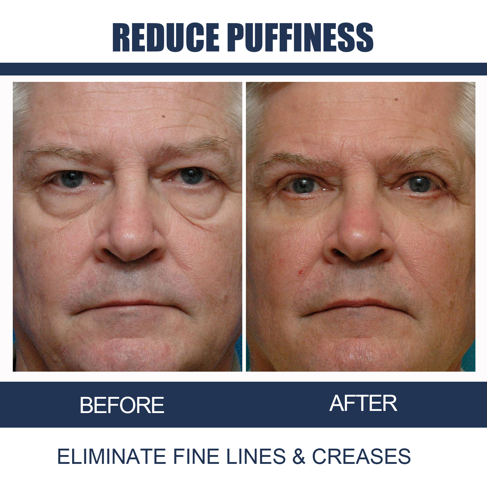 Men Care Eye Cream Mild Moisturizing Non Greasy Relieve Dryness Nourish Delicate Skin Around Eyes