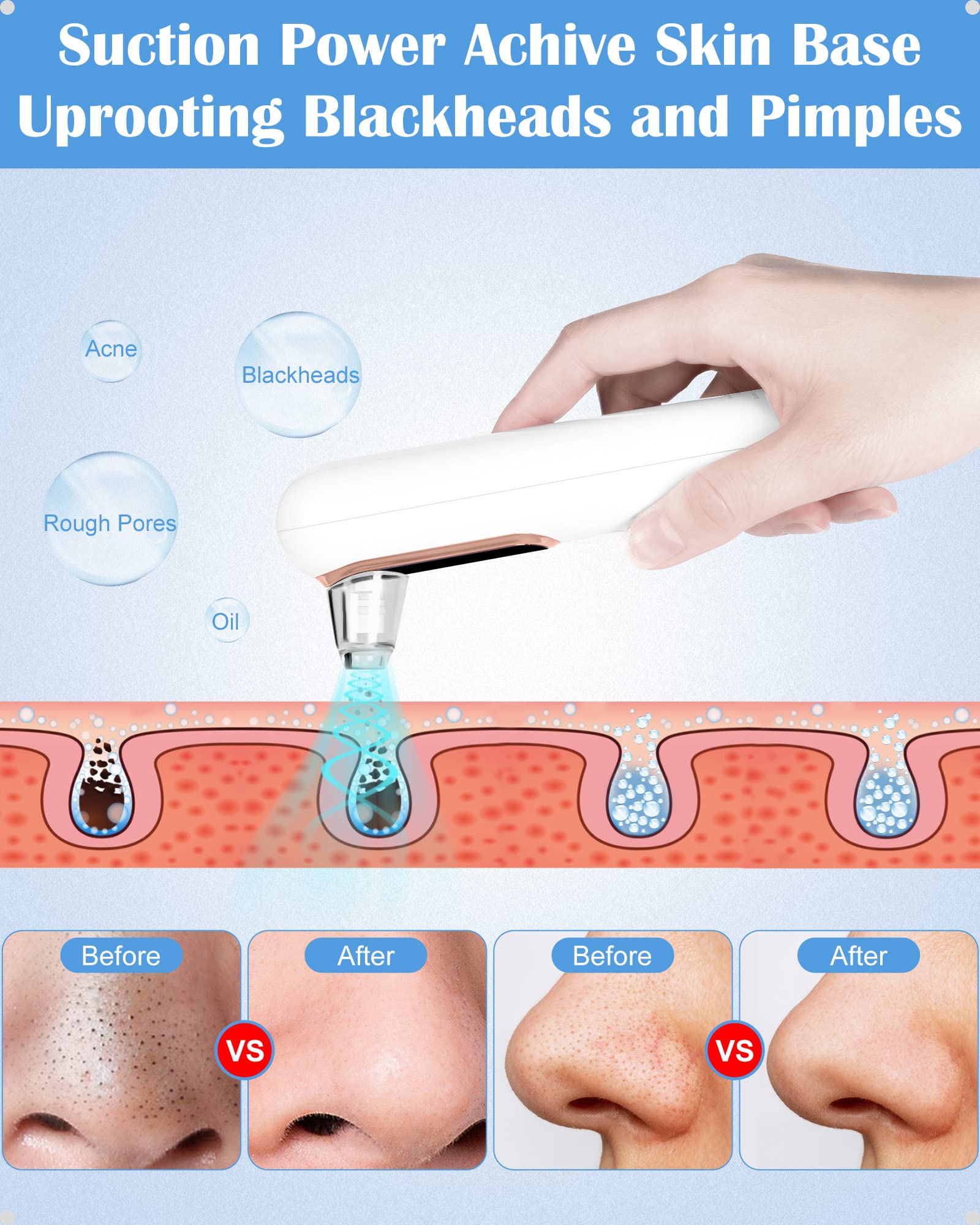 Electric Blackhead Remover Facial Cleansing Pore Cleaner Rechargeable Pimple Extractor Acne Whitehead Extractor Vacuum Suction Tool Facial Cleansing