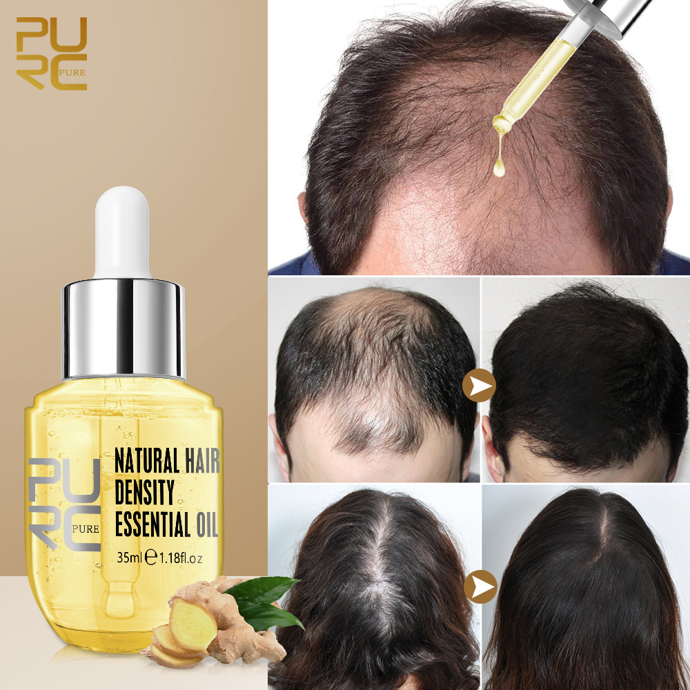 Natural Ginger Hair Growth Oil Prevent Hair Loss Essential Oil Smoothing Repair Damaged Hair Growth Products for Men Women Hair Care 35ml