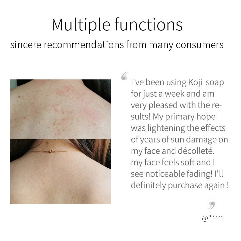 Kojic Acid Soap For Skin Cleansing Deep Pore Cleaning And Brightening Body And Face Cleansing Bar 100g