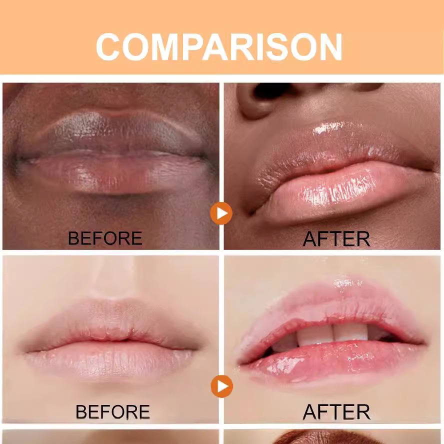 Lanthome Turmeric Lip Balm For Moisturizing Nourishing And Soothing Dry Lips Daily Lip Care Treatment 5g