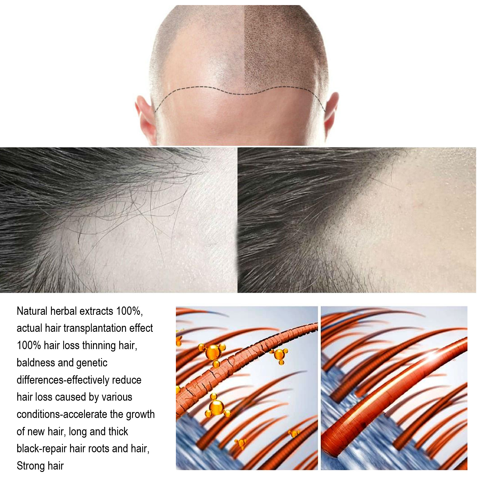 Biotin Fast Hair Growth Oil South Moon Hair Regrowth Serum Hair Thinning Treatment Hair Growth Liquid Anti-loss for Women Men 20ml