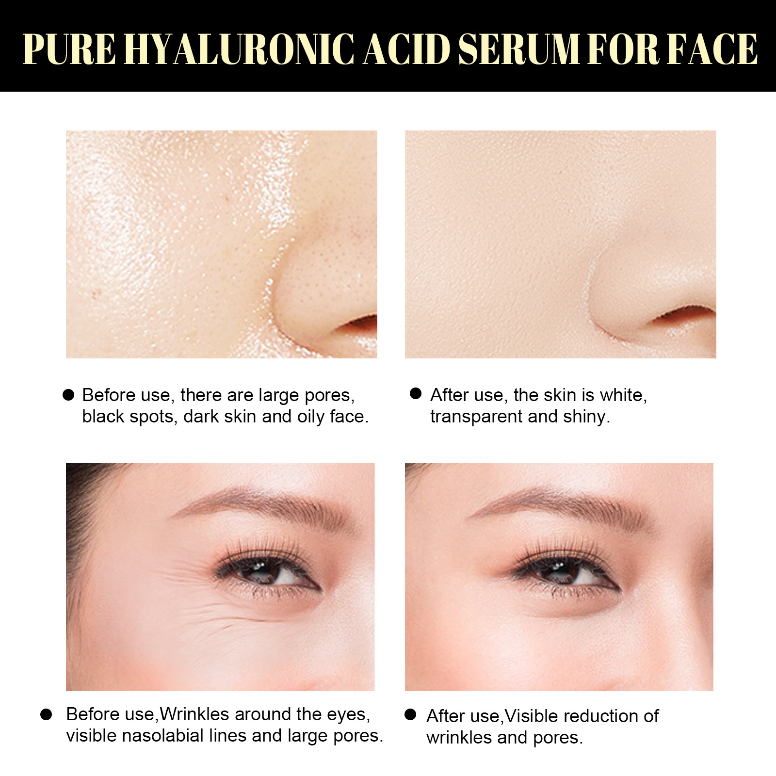 (20pcs Set) Protein Thread Lifting Face Lift Protein Lines Korean Protein Lifting Collagen Thread Plump Your Face Lift And Firm The Facial Contours Moisturizing