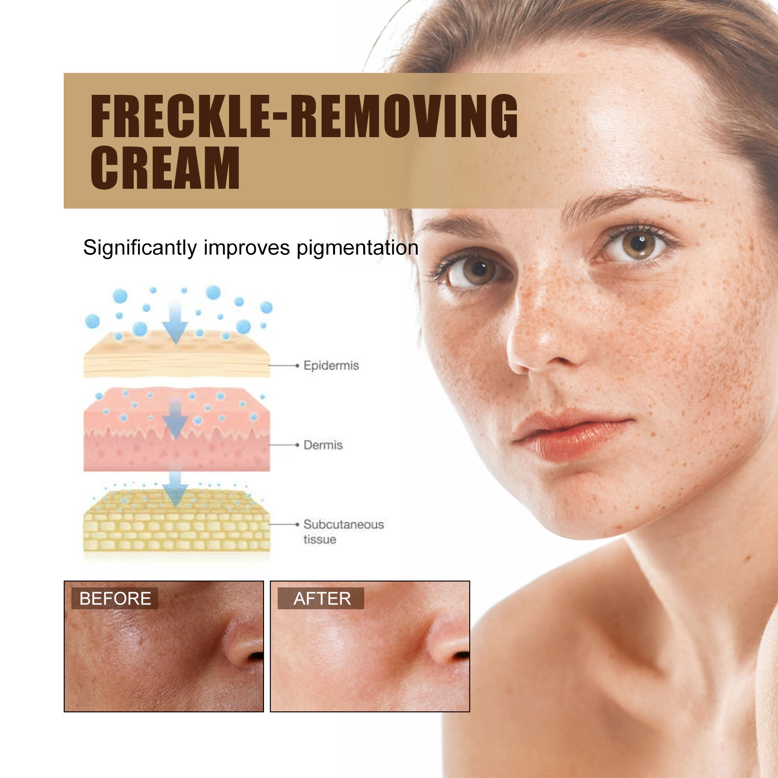Freckle-Removing Cream Spot Off Freckle Whitening Fades Spots and Brightens Skin Tone Dark Spot Remover Moisturizing Skin Care