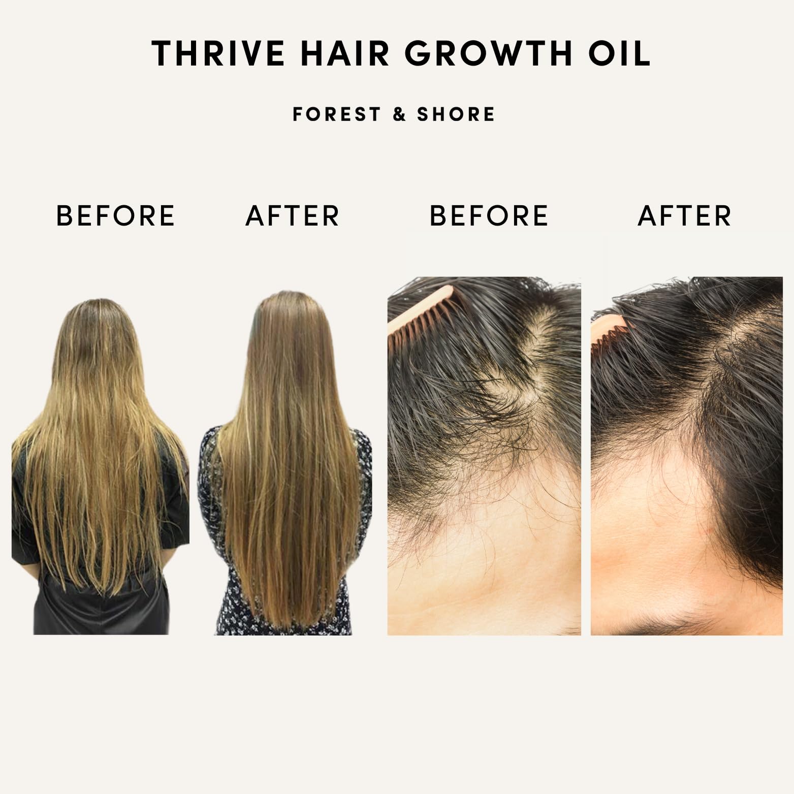 Hair Growth Oil Natural Hair Oil with Caffeine Biotin Castor Oil Argan Oil Coconut Oil and Rosemary Oil Effective Thickening MaskHair Loss Treatment