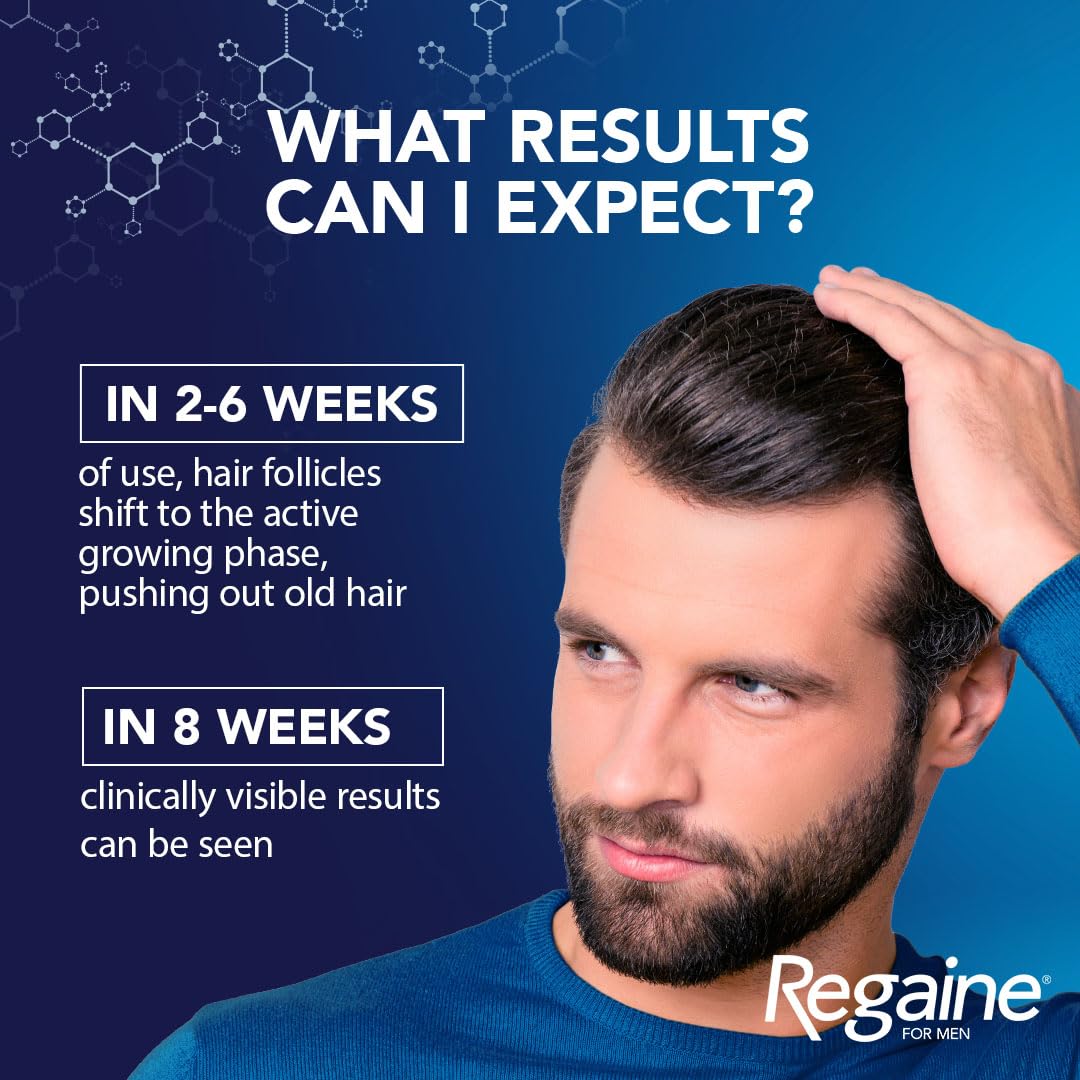 Regaine For Men Hair Regrowth Foam 3 x 73ml Packing May Vary