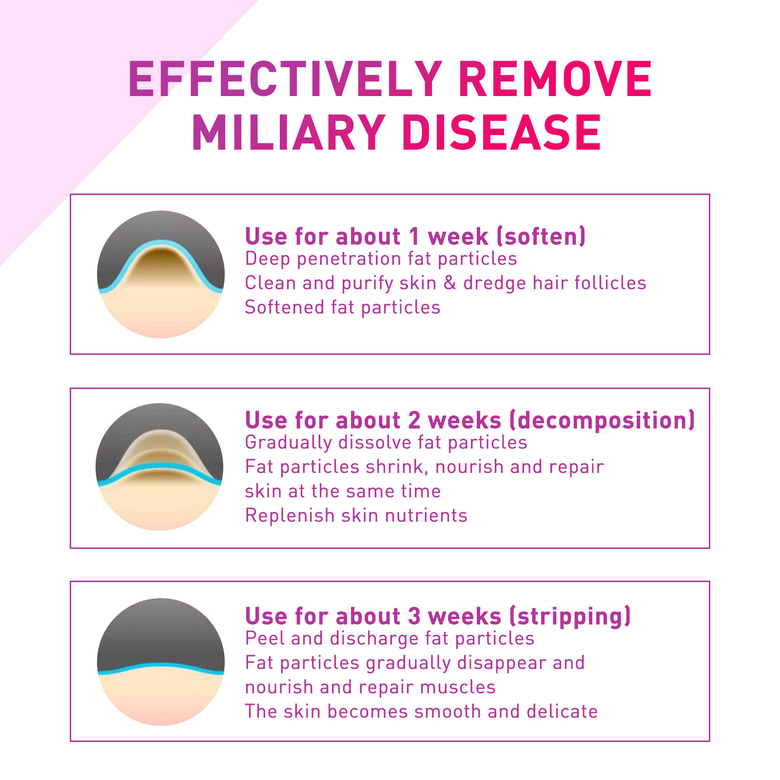 (1 PC) Fat Granules Removal Eye Serum Milia Spot Treatment Puffiness Repair Fine Lines Eye Bag Oil Control Moisturize Essence Eye Skin Soothing Remove Particles Around the Eyes