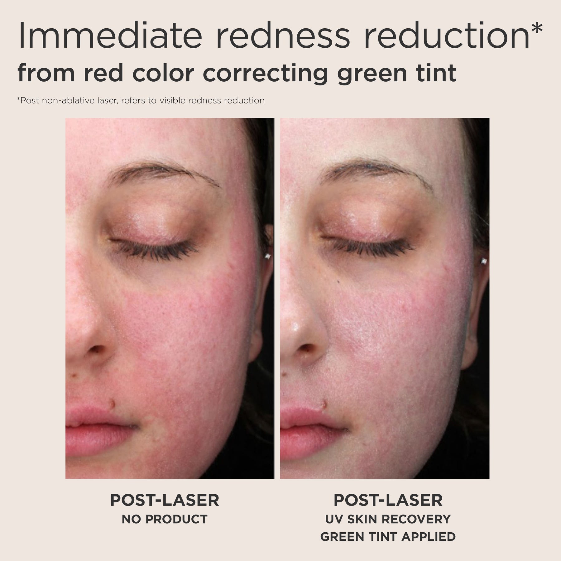 EltaMD Green Tint Sunscreen UV Skin Recovery Red Color Correcting Green Tint Broad Spectrum SPF 50 1.7 oz / 48g
