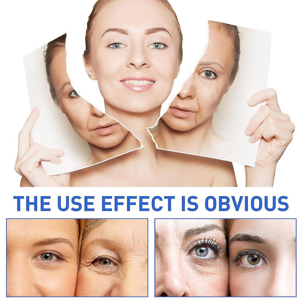 4x 30ml Botulinum Wrinkle Remover Instant Anti-aging Face Serum Retinol Skin Tightening