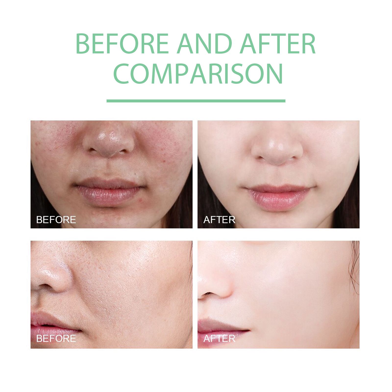 Herbal Facial Gel Gentle Cleansing Moisturizing Exfoliating For Smooth And Refreshed Skin Daily Care