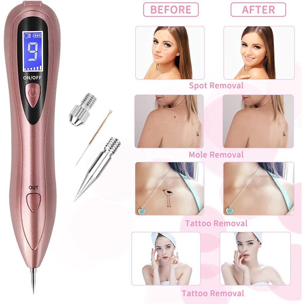 Mole Removal Pen for Freckle Watt Age Spots Nevus and Small Tattoo
