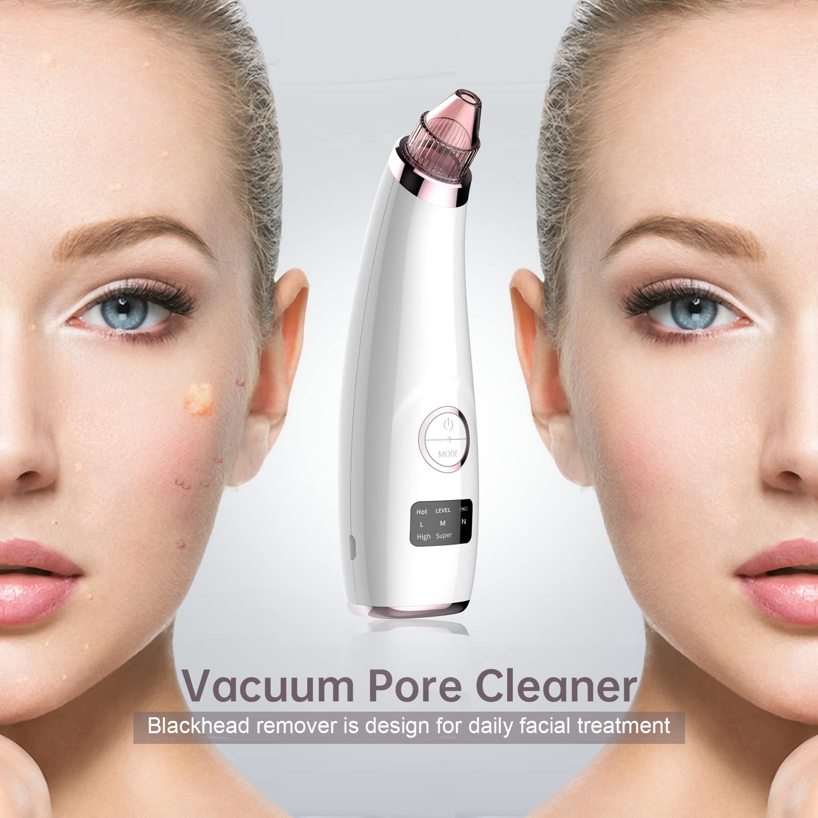 Blackhead Remover Vacuum Blackhead Extractor Face Pore Cleaner