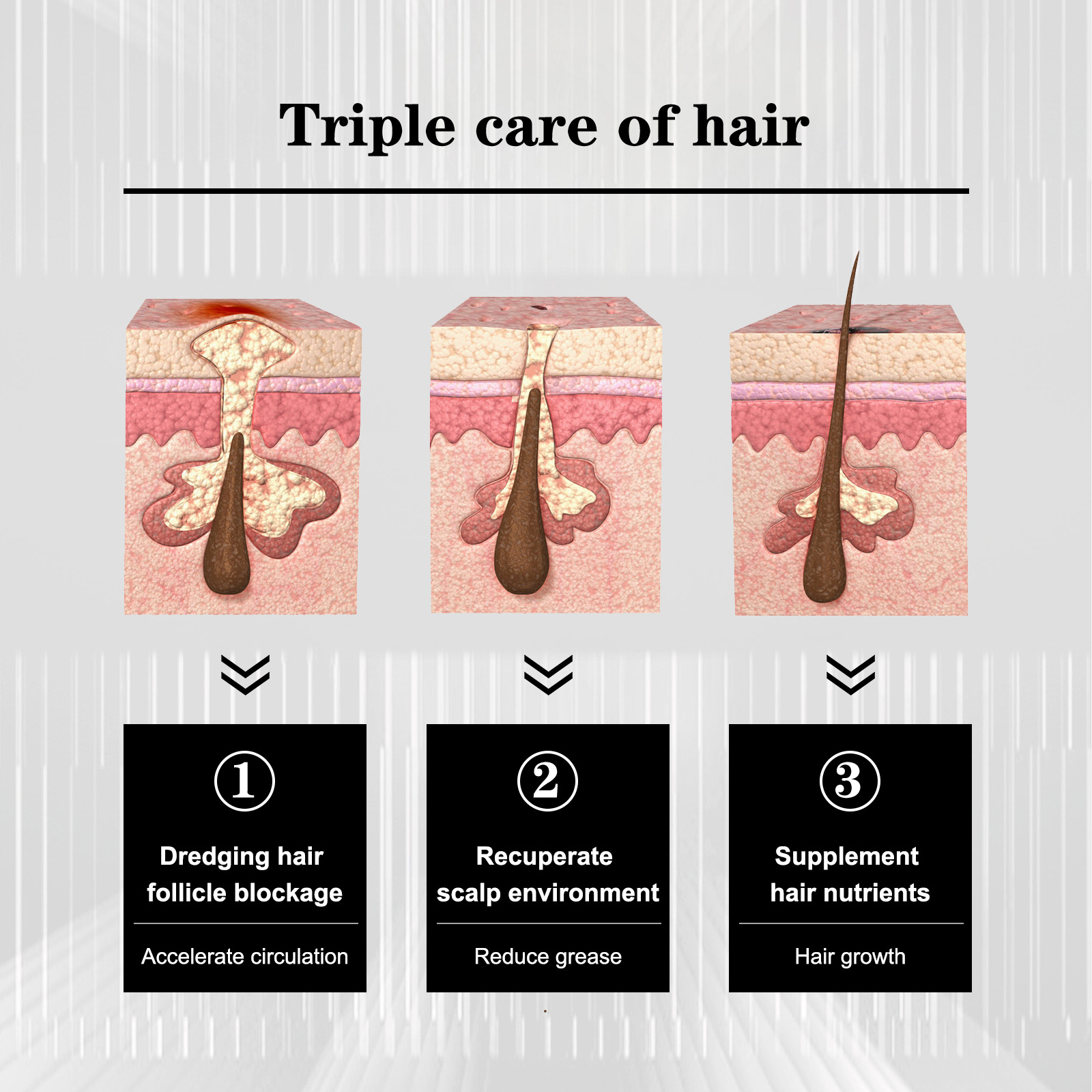 Anti Shedding Hair Spray Hair Growth Essence Hair Care Serums Improves Hairline Density Strengthens Hair Nourishes Hair Root Gel 100ml