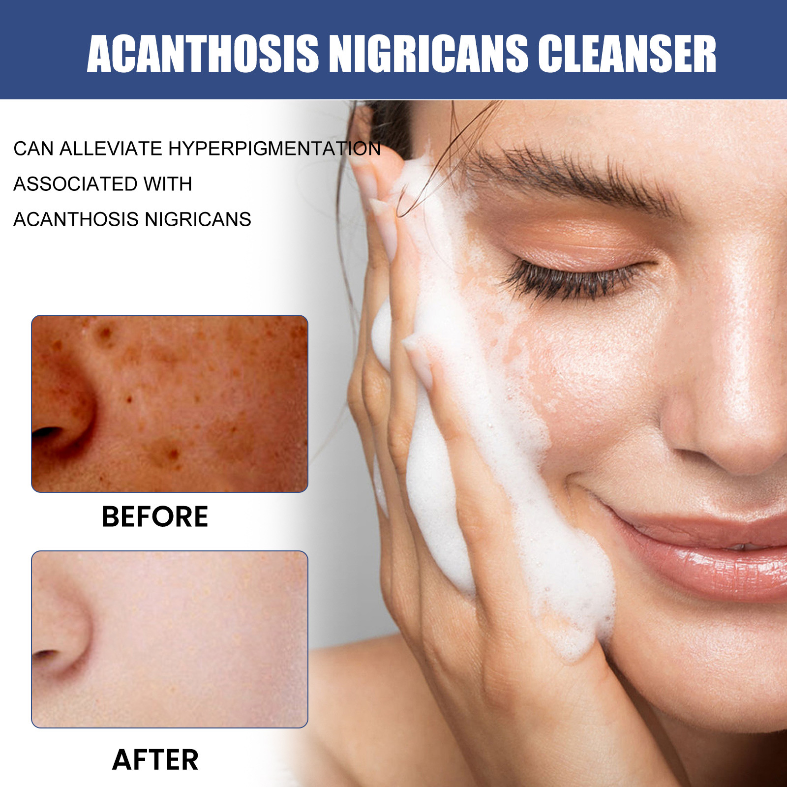 Cleansing Lotion Whitening Face Cleanser Oil Control Cleanser Acne Spots Deep Cleaning Reducing Pores Moisturizing Facial Repair Brightening Skin Tone