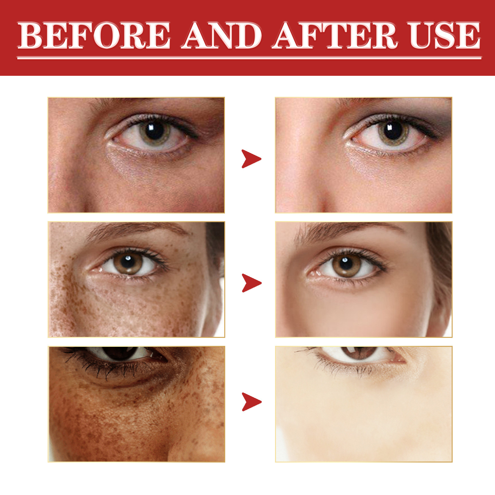 Whitening Freckle Cream Reduce Melasma Improve Dullness Spots Lightening Pigment Corrector Whitening Skin Tone Repair Sunburn Fade Dark Spots Remove Facial Blemish