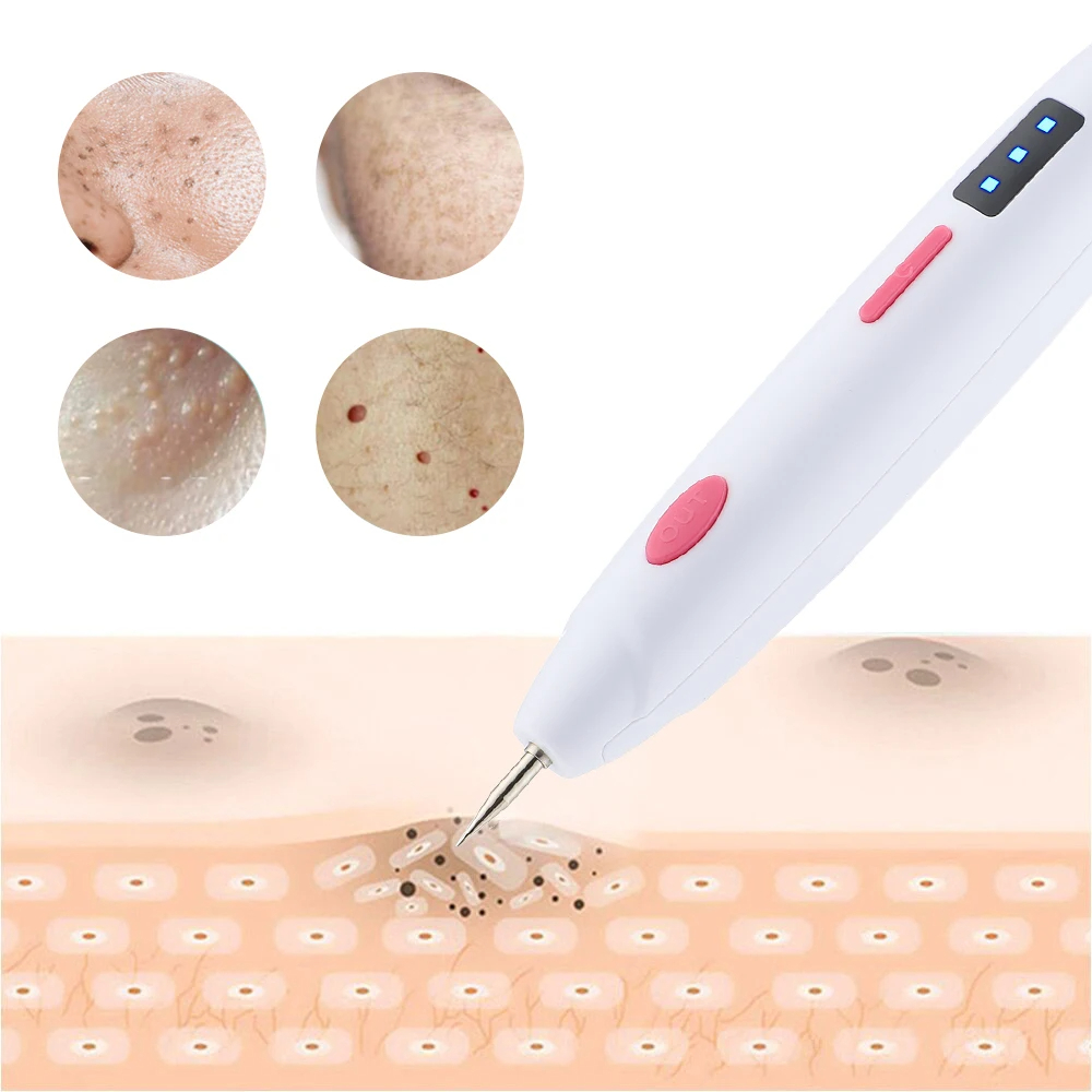 Freckle Remover Mini Mole Pen Black Dot Spots Fat Granules Pimples Tattoos Warts Skin Tag Removal Electric Laser Plasma Pen Beauty Tools Machine