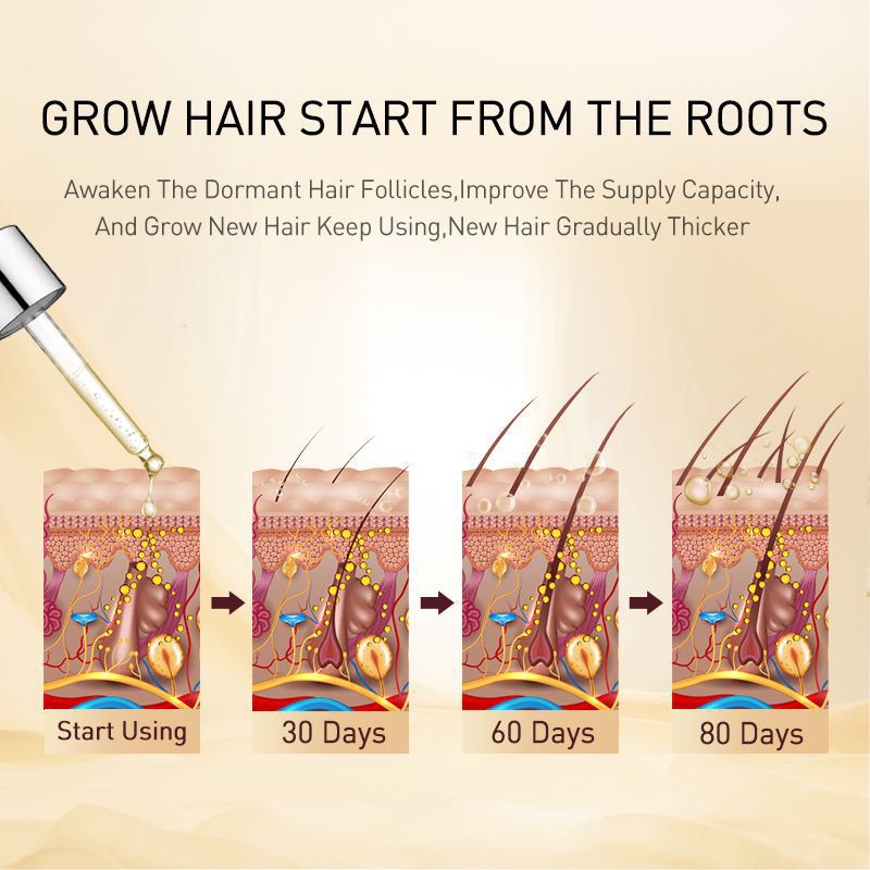 Natural Ginger Hair Growth Oil Prevent Hair Loss Essential Oil Smoothing Repair Damaged Hair Growth Products for Men Women Hair Care 35ml