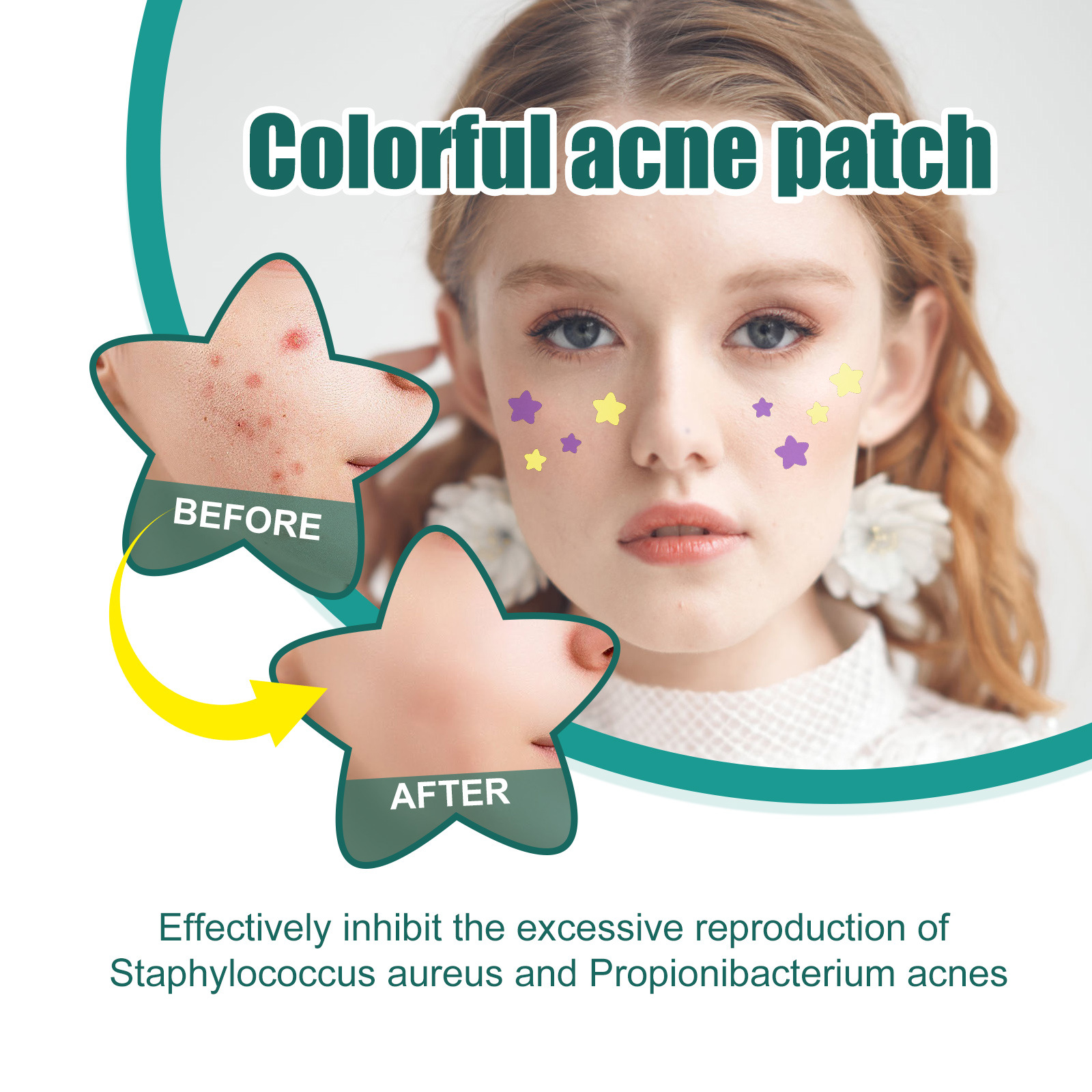 EELHOE Mini Cute Star-shaped Invisible Acne Removal Pimple Patch Beauty Acne Tools Face Spot Beauty Makeup