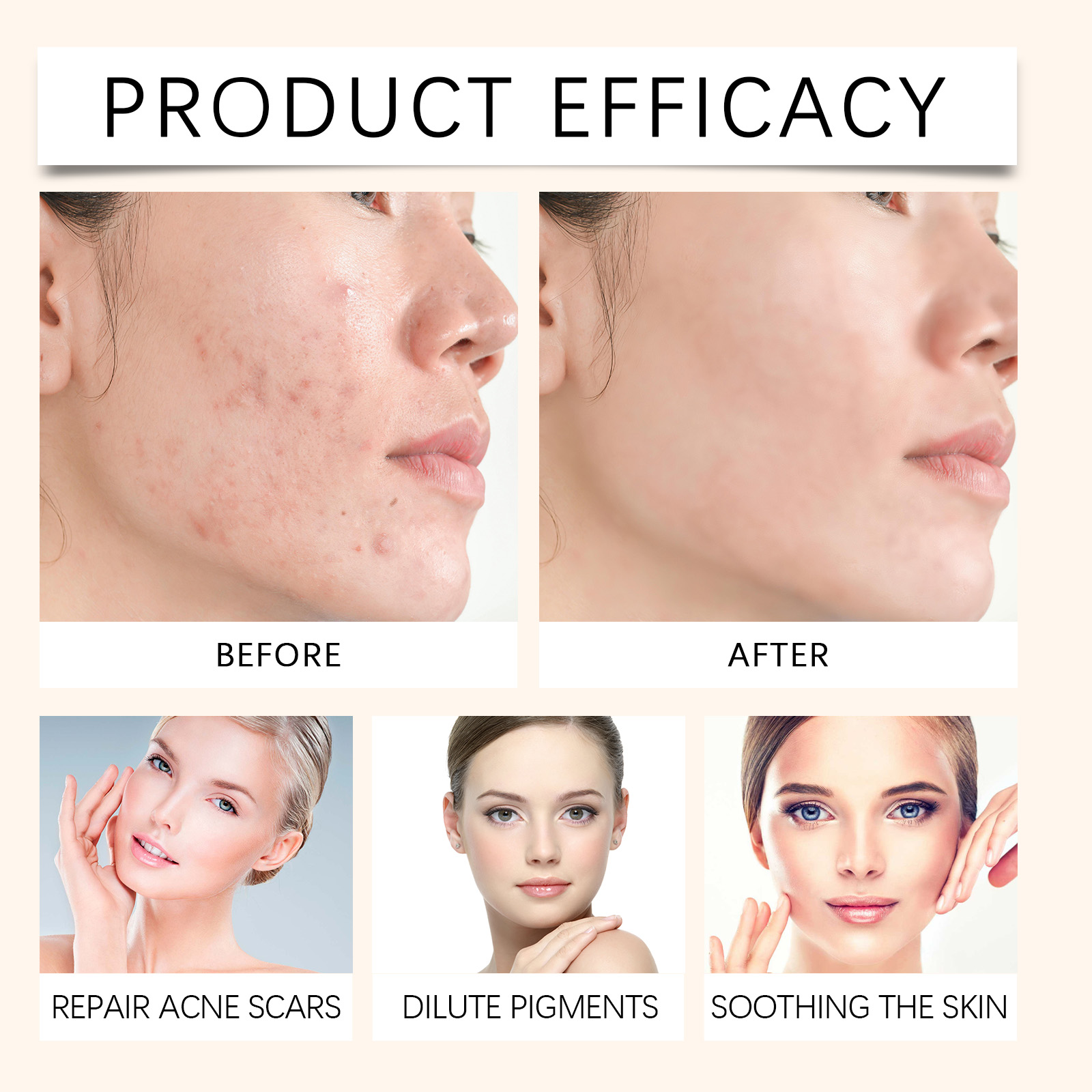 Acne Care Liquid Moisturizing Hydrating Softening Target Blemishes Refining Pores Facial Skin Essence