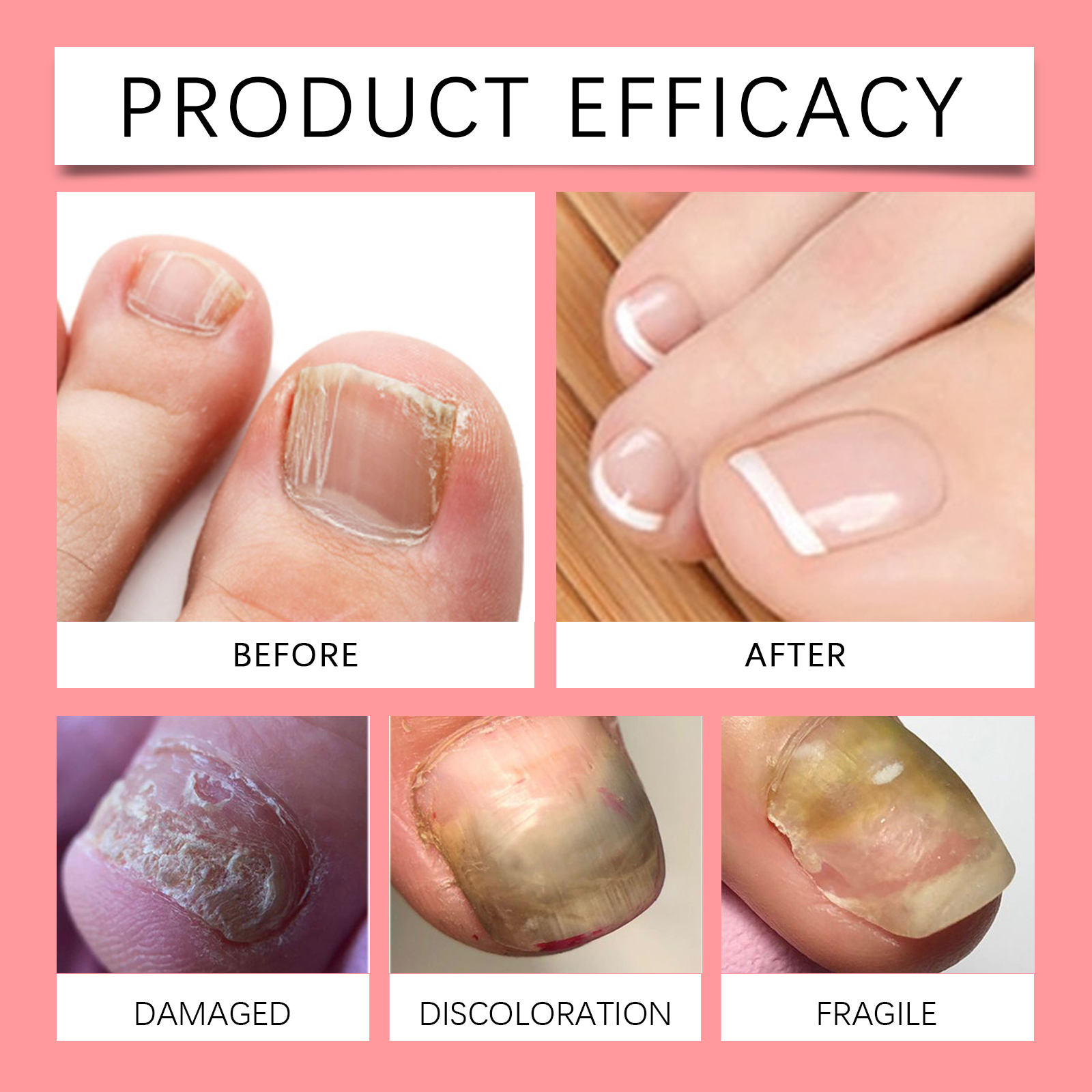 Nail Care Drops Nourish Moisturize Shine Harden Mild Clean Comfort Repair Protect Cuticle Finger Toe