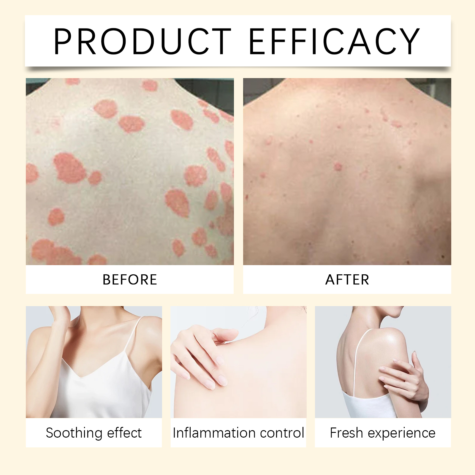 Skin Care Cream Gentle Massage Deep Moisturizing Nourishing Protect Soft Smooth Apply On Body Skin Surface