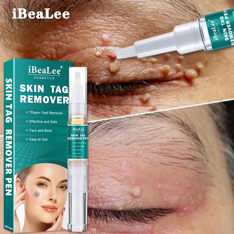 iBeaLee Skin Tag Remover Tagwort Removal 7 Days 5ml