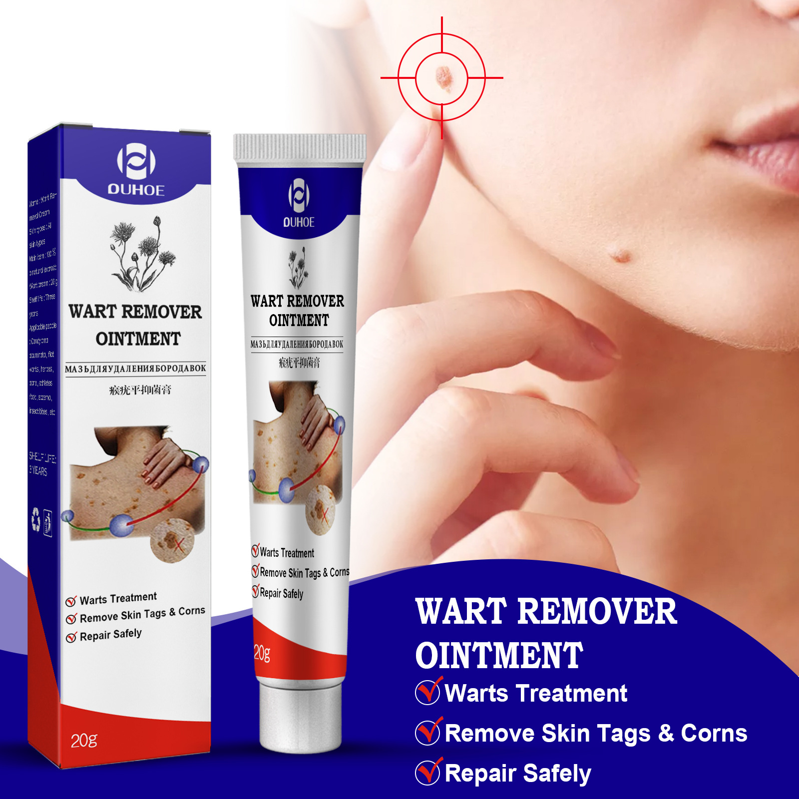 Ouhoe Skin Tag Remover Warts Remover Ointment Mole Remover Cream Mole Corrector Safe Painless Remove Skin Tag Callus Skin Treatment Ointmen