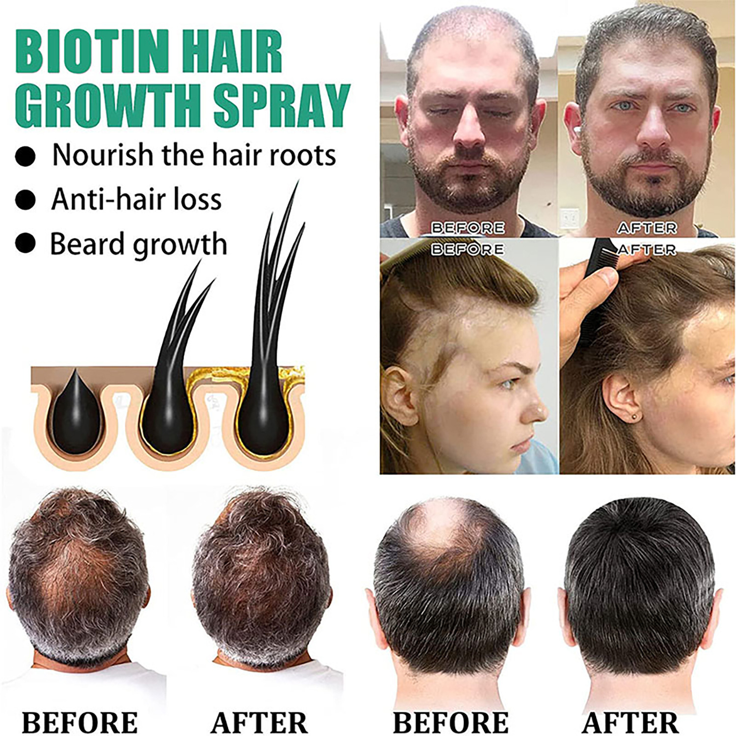 Black Sesame Hair Growth Essence Strengthening and Moisturizing Hair Root Repair Improves Anti Hair Loss and Hair Retention Dense Hair Essential Oil 30ml