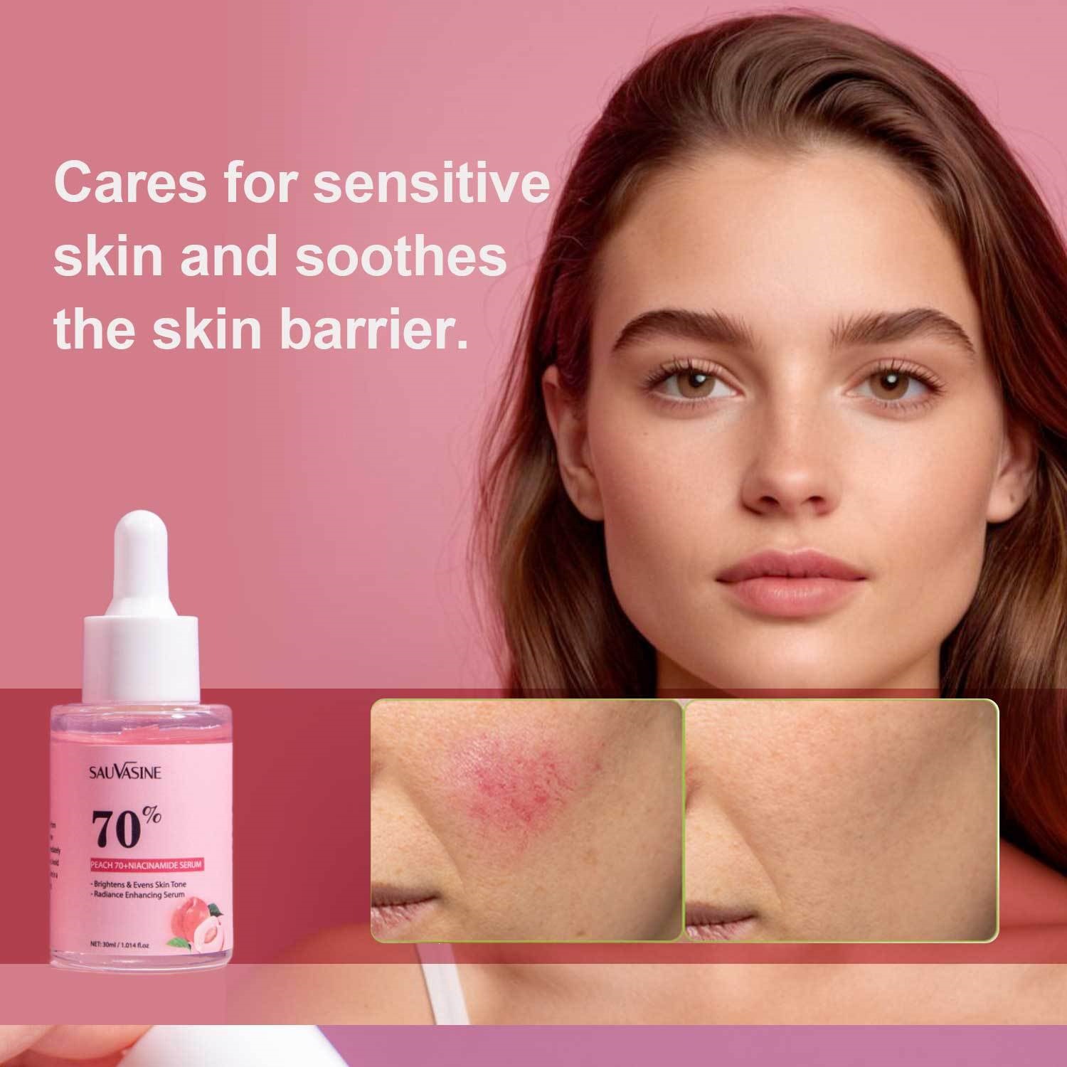 Peach 70 Percent Niacinamide Essence Liquid For Hydrating Moisturizing And Fine Line Reduction Facial Serum