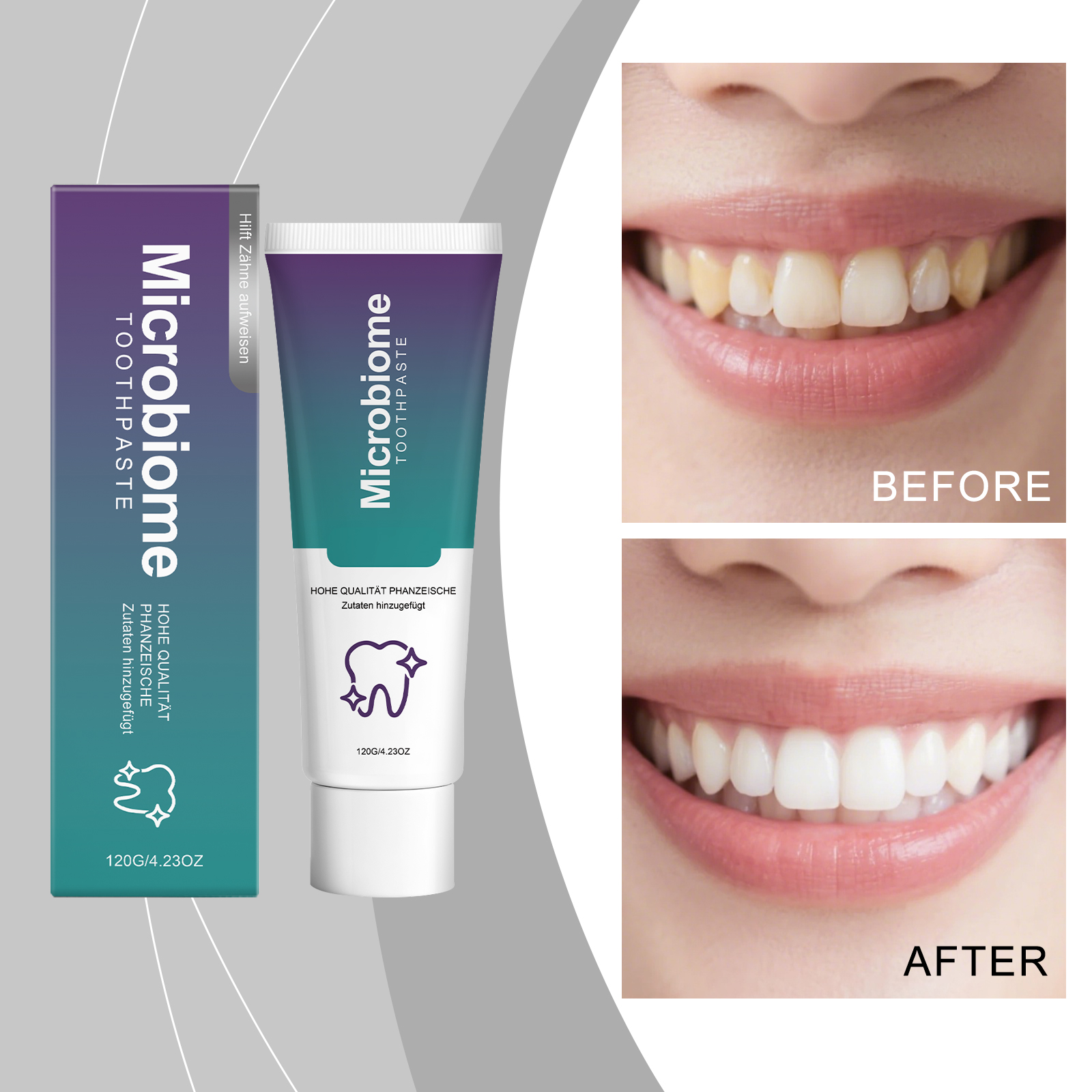 Mint Toothpaste Cleans Teeth Surface Freshens Breath Refreshing Texture Non Sticky For Daily Oral Care
