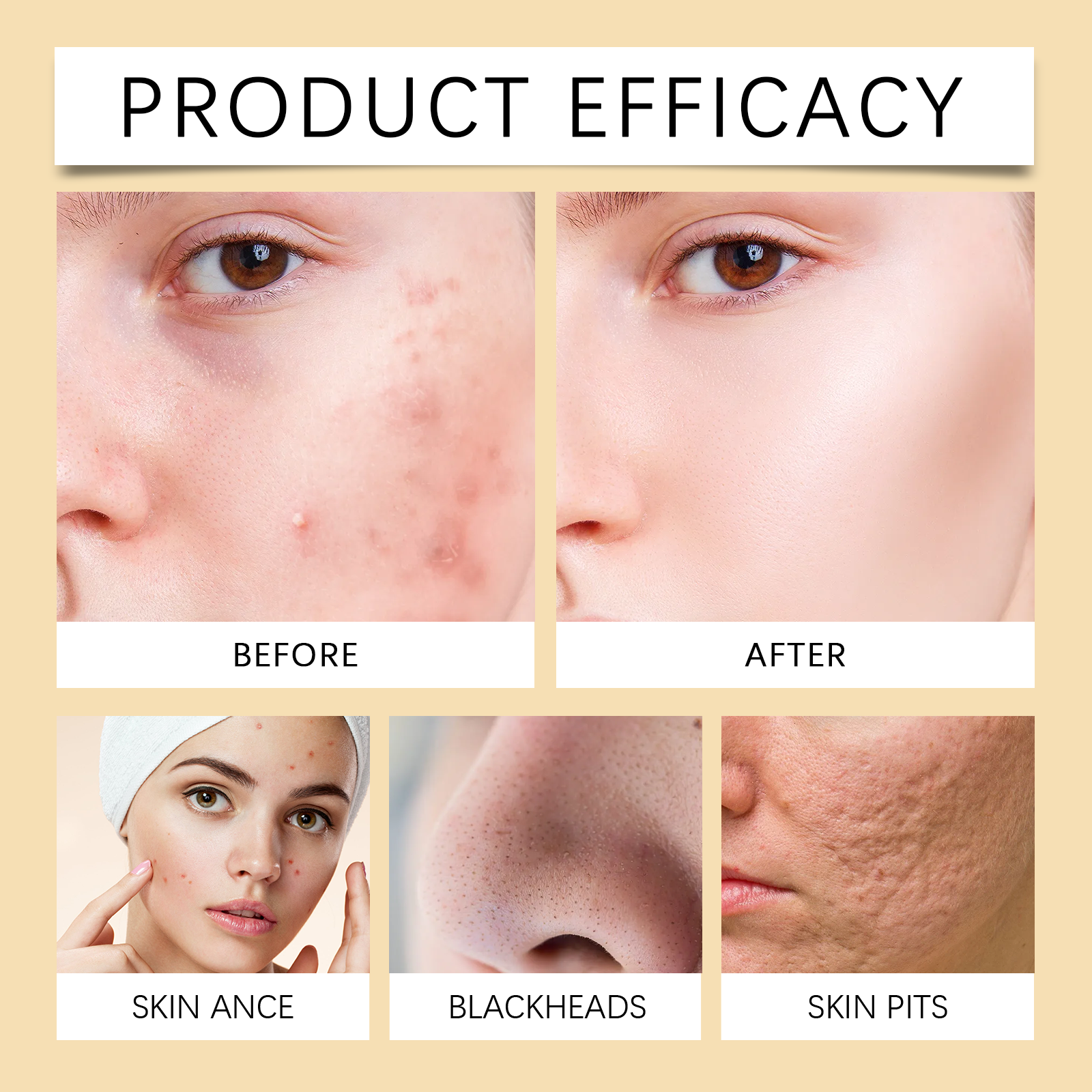 Turmeric Cleanser Gently Cleanses Facial Pores Skin Refreshing Oil Control Moisturizing Lock Water Face