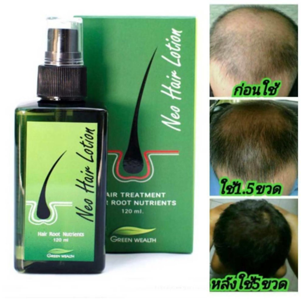 Neo Hair Lotion Extra Strength Regrowth Serum Hair Treatment 120 Ml